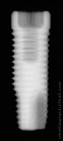 Radiograph of ProActive