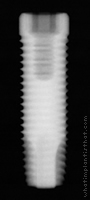 Radiograph of ProActive