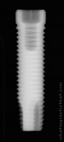 Radiograph of ProActive