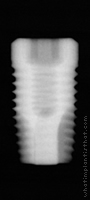 Radiograph of ProActive