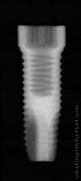 Radiograph of ProActive