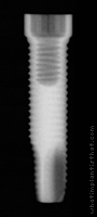 Radiograph of ProActive
