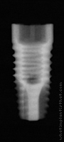 Radiograph of ProActive