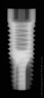 Radiograph of ProActive
