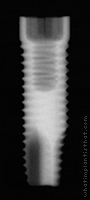 Radiograph of ProActive