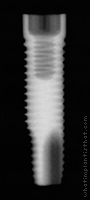 Radiograph of ProActive