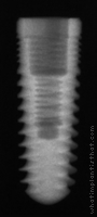 Radiograph of ReActive