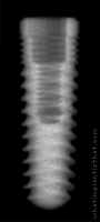 Radiograph of ReActive