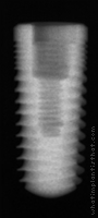 Radiograph of ReActive