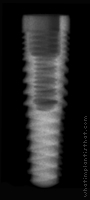 Radiograph of ReActive