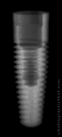 Radiograph of RePlant