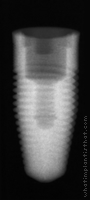 Radiograph of RePlant