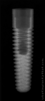 Radiograph of RePlant
