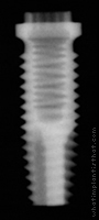 Radiograph of Stern EX