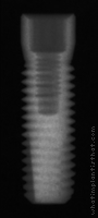 Radiograph of Renova RBM Straight