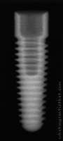 Radiograph of Renova RBM Tapered