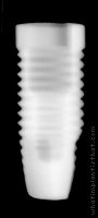 Radiograph of Replace Select Straight RP