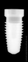 Radiograph of Replace Select Tapered HA 2mm
