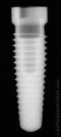 Radiograph of Replace Select