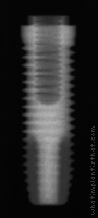 Radiograph of Restore RD
