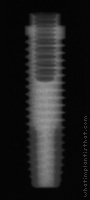 Radiograph of Restore SD