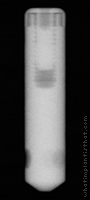 Radiograph of Restore TPS Coated