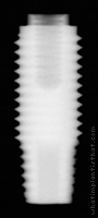 Radiograph of Restore