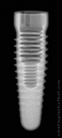 Radiograph of Root-Line 2 (K-Series)