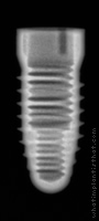 Radiograph of Root-Line 2 (K-Series)