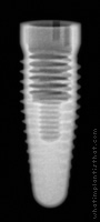 Radiograph of Root-Line 2 (K-Series)