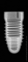 Radiograph of Root-Line 2 (K-Series)