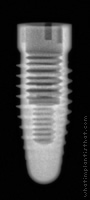 Radiograph of Root-Line (J-Series)