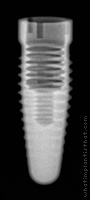 Radiograph of Root-Line (J-Series)
