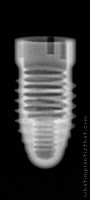 Radiograph of Root-Line (J-Series)