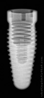 Radiograph of Root-Line (J-Series)
