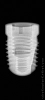 Radiograph of Root-Line (J-Series)