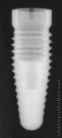 Radiograph of Root-Line