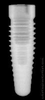Radiograph of Root-Line
