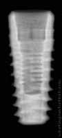 Radiograph of Implantswiss | S-BFHR4310