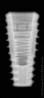 Radiograph of Implantswiss | S-BFHR4810