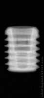 Radiograph of Implantswiss | S-BMFSR4305 – bone level short