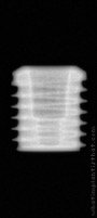 Radiograph of Implantswiss | S-BMFSR4805 – bone level short