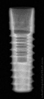 Radiograph of Implantswiss | S-BMFSR3310