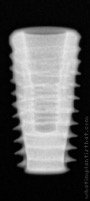 Radiograph of Implantswiss | S-BWFHR5510