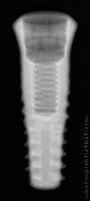 Radiograph of Implantswiss | S-TFHR3710
