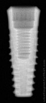 Radiograph of Implantswiss | S-TFHR4310