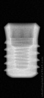 Radiograph of Implance | S-TFSR4805 – tissue level short