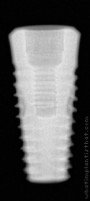 Radiograph of Implantswiss | S-TWFHR5510