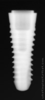 Radiograph of SPI Contact