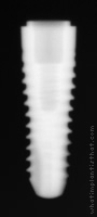 Radiograph of SPI Contact